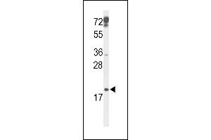 CDKN2D 抗体  (N-Term)
