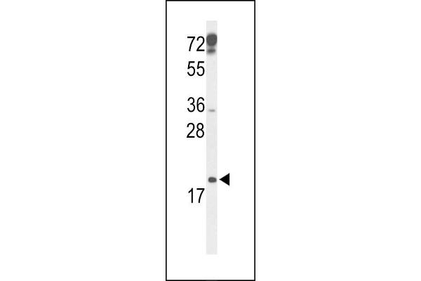 CDKN2D 抗体  (N-Term)