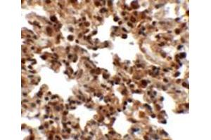 Immunohistochemistry of FXYD7 in rat lung tissue with FXYD7 antibody at 2. (FXYD7 抗体  (N-Term))