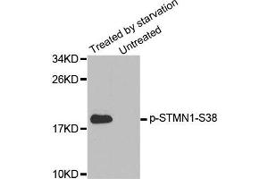 Western blot analysis of extracts from K562 cells, using Phospho-STMN1-S38 antibody. (Stathmin 1 抗体  (pSer38))