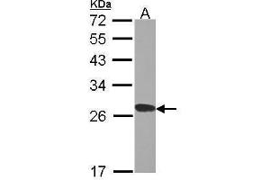 WB Image Sample (30 ug of whole cell lysate) A: H1299 12% SDS PAGE RPL15 antibody antibody diluted at 1:1000 (RPL15 抗体)
