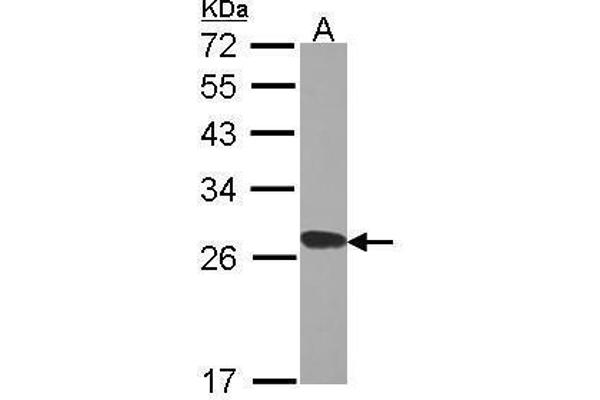 RPL15 抗体