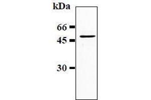 Western Blotting (WB) image for anti-Glial Fibrillary Acidic Protein (GFAP) antibody (ABIN1449150) (GFAP 抗体)