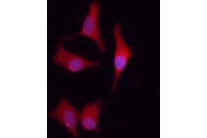 ABIN6261639 and ABIN6276641 staining HeLa cells by IF/ICC.