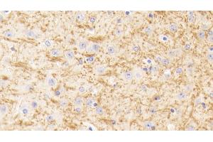 Detection of TUBb1 in Mouse Cerebrum Tissue using Polyclonal Antibody to Tubulin Beta 1 (TUBb1) (TUBB1 抗体  (AA 182-437))