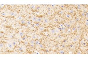 Detection of TUBb1 in Mouse Cerebrum Tissue using Polyclonal Antibody to Tubulin Beta 1 (TUBb1) (TUBB1 抗体  (AA 182-437))