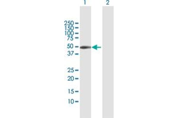 Coxsackie Adenovirus Receptor 抗体  (AA 1-365)
