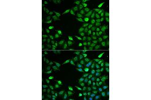 Immunofluorescence analysis of A549 cell using INTS6 antibody. (INTS6 抗体)