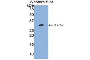 Detection of Recombinant GP5, Mouse using Polyclonal Antibody to Cluster of Differentiation 42d (CD42d) (GP5 抗体  (AA 246-485))