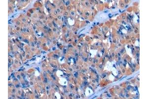 Immunohistochemistry (IHC) image for anti-Cytochrome P450, Family 1, Subfamily B, Polypeptide 1 (CYP1B1) (AA 374-516) antibody (ABIN7435466)