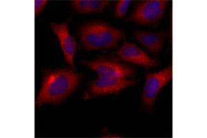Immunofluorescence of human HeLa cells stained with Hoechst 3342 (Blue) for nucleus staining and BAK1 monoclonal antibody, clone AT8B4  (1 : 500) with Texas Red (Red). (BAK1 抗体  (AA 29-187))