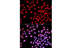 Immunofluorescence analysis of U2OS cell using IKZF1 antibody. (IKZF1 抗体  (AA 1-270))