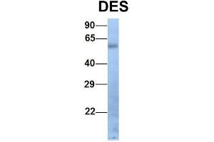 Host:  Rabbit  Target Name:  DES  Sample Type:  Human Fetal Lung  Antibody Dilution:  1. (Desmin 抗体  (Middle Region))