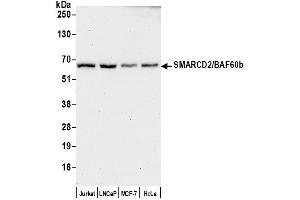 Western Blotting (WB) image for anti-SWI/SNF Related, Matrix Associated, Actin Dependent Regulator of Chromatin, Subfamily D, Member 2 (SMARCD2) (AA 425-475) antibody (ABIN7453206)