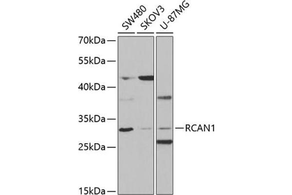 RCAN1 anticorps  (AA 60-245)