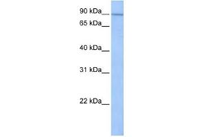 UNC84A antibody used at 1 ug/ml to detect target protein. (SUN1 抗体)