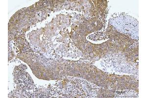 IHC analysis of AGPS using anti-AGPS antibody (ABIN7600146).