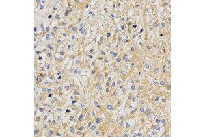 Immunohistochemistry (IHC) image for anti-Amyloid beta (A4) Precursor-Like Protein 2 (APLP2) antibody (ABIN1876643) (APLP2 抗体)