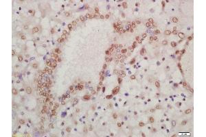 Immunohistochemistry (Paraffin-embedded Sections) (IHC (p)) image for anti-Homeobox A13 (HOXA13) (AA 332-388) antibody (ABIN1386749)
