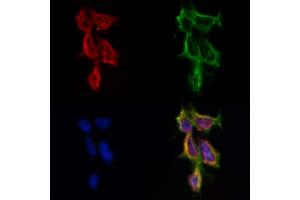 ABIN6262174 and ABIN6269018 staining HepG2 by IF/ICC. (HDAC10 抗体  (N-Term))