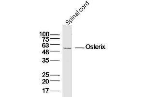 Mouse spinal cord lysates probed with Osterix Polyclonal Antibody, unconjugated  at 1:300 overnight at 4°C followed by a conjugated secondary antibody for 60 minutes at 37°C. (SP7 抗体  (AA 331-431))