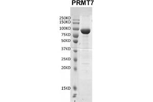 Recombinant PRMT7 protein gel. (PRMT7 Protein (DYKDDDDK Tag))
