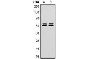 Western blot analysis of Carbonic Anhydrase 9 expression in Hela (A), 293T (B) whole cell lysates. (CA9 抗体)