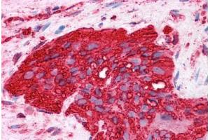 HumanColon, myenteric plexus: Formalin-Fixed, Paraffin-Embedded (FFPE) (alpha Tubulin 抗体)