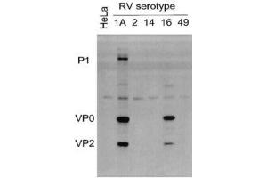 Lysates of HeLa cells infected with RV serotypes 1A, 2, 14, 16 or 49 and blotted with ABIN1000236 (Rhinovirus 16 抗体)