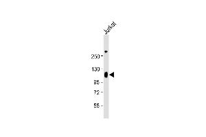 Anti-LP2 Antibody (Center) at 1:2000 dilution + Jurkat whole cell lysate Lysates/proteins at 20 μg per lane. (LAMP2 抗体  (AA 196-225))