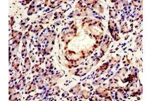 Immunohistochemistry (IHC) image for anti-Cleavage and Polyadenylation Specific Factor 6, 68kDa (CPSF6) (AA 186-226) antibody (ABIN7147925)