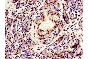 Immunohistochemistry of paraffin-embedded human pancreatic tissue using ABIN7147925 at dilution of 1:100 (CPSF6 抗体  (AA 186-226))