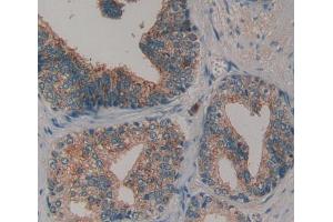 Immunohistochemistry (IHC) image for anti-Collagen, Type VI (COL6) (AA 1-336) antibody (ABIN5013367)