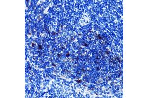 Immunohistochemistry (IHC) image for anti-S100 Calcium Binding Protein B (S100B) antibody (ABIN7270131)