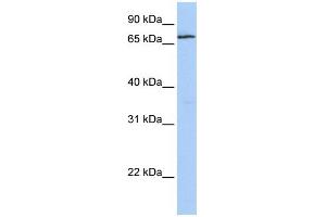 WB Suggested Anti-ZNF548 Antibody Titration:  0. (ZNF548 抗体  (N-Term))