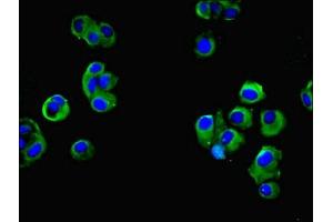 Immunofluorescent analysis of MCF-7 cells using ABIN7165366 at dilution of 1:100 and Alexa Fluor 488-congugated AffiniPure Goat Anti-Rabbit IgG(H+L) (FAM118A 抗体  (AA 51-357))
