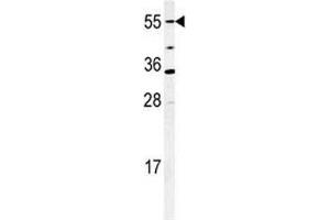 Western blot analysis of CYP26A1 antibody and mouse NIH3T3 cell lysate. (CYP26A1 抗体  (AA 467-497))
