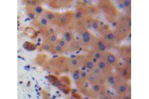Used in DAB staining on fromalin fixed paraffin-embedded Liver tissue (IL17C 抗体  (AA 36-187))