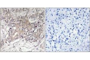 Immunohistochemistry (IHC) image for anti-Glucosaminyl (N-Acetyl) Transferase 3, Mucin Type (GCNT3) (AA 226-275) antibody (ABIN1534685)
