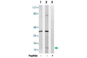 Western blot analysis of extracts from K-562 cells (Lane 1) and Jurkat cells (Lane 2 and lane 3), using C6orf108 polyclonal antibody . (RCL 抗体)