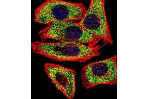 Fluorescent confocal image of  cell stained with TGM2 Antibody (Center ) (ABIN392285 and ABIN2841950). (Transglutaminase 2 抗体  (AA 429-458))