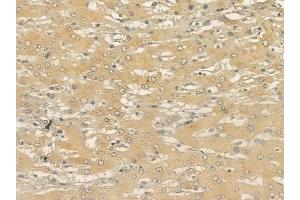 ABIN6265508 and ABIN6273329 at 1/100 staining human normal lung tissue by IHC-P.