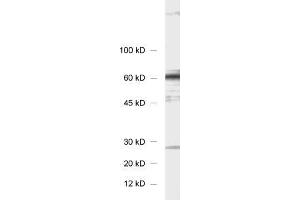 dilution: 1 : 1000, sample: 3T3 fibroblasts (STXBP4 抗体)