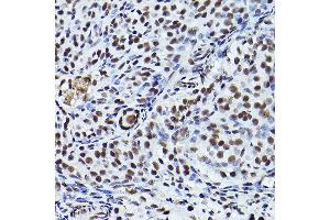 Immunohistochemistry of paraffin-embedded rat ovary using Phospho-ATR-T1989 Rabbit pAb (ABIN7265777) at dilution of 1:200 (40x lens). (ATR 抗体  (pThr1989))