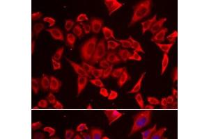 Immunofluorescence analysis of HeLa cells using SLC20A2 Polyclonal Antibody (SLC20A2 抗体)