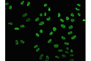 Immunofluorescence staining of Hela cells (treated with 30mM sodium butyrate for 4h) with ABIN7139161 at 1:5, counter-stained with DAPI. (Histone H2B 抗体  (acLys15))