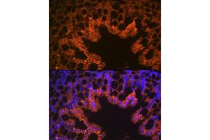 Immunofluorescence analysis of mouse large intestine using LI Cadherin/Cadherin-17 Rabbit mAb (ABIN7268249) at dilution of 1:100 (40x lens). (LI Cadherin 抗体)