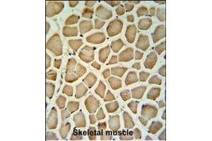 Calponin-3 Antibody (N-term) (ABIN390503 and ABIN2840859) IHC analysis in formalin fixed and paraffin embedded human skeletal muscle tissue followed by peroxidase conjugation of the secondary antibody and DAB staining. (CNN3 抗体  (N-Term))