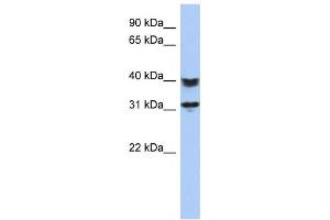 Western Blotting (WB) image for anti-Chromosome 5 Open Reading Frame 35 (C5orf35) antibody (ABIN2459640) (C5orf35 抗体)