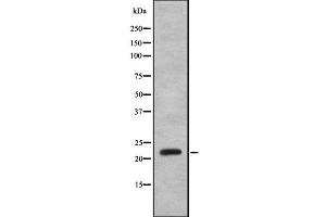 Western blot analysis IFNA8 using K562 whole cell lysates (IFNA8 抗体  (Internal Region))